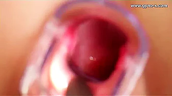 Anetta Gyno Lesbian Fetish Video