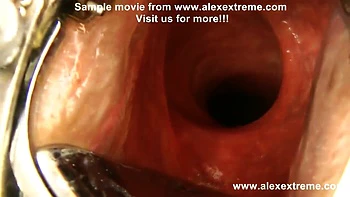 Extreme Anal Fisting, Huge Dildos And Prolapse Compilation From Alexextreme 30-46